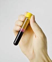 Selphyl Blood Collection and Separation Tube